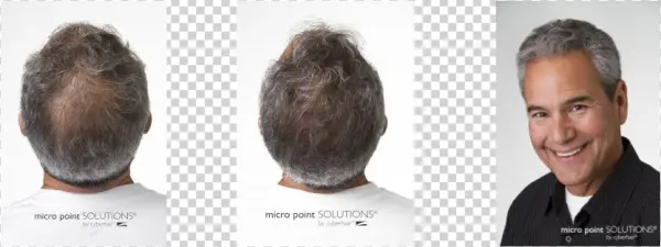 Micropointlinks - Biotopic - Premium Hair Growth Shampoo With Biotin