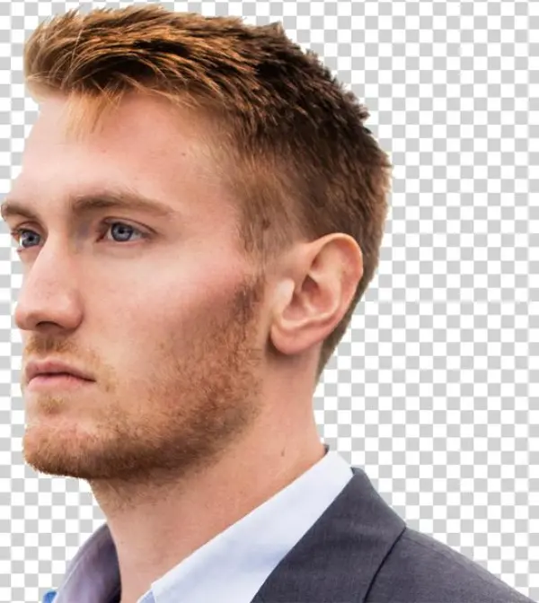 Male Rhinoplasty Nj - Gentleman