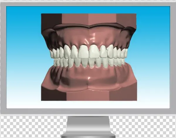 Digital Model Screen