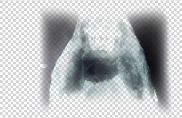 Bones