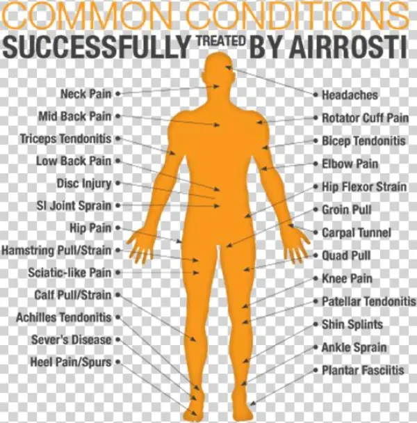 Injury - Diagram