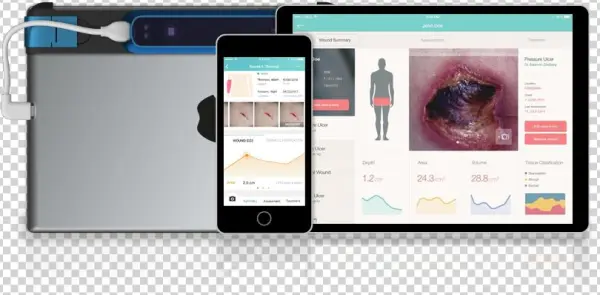 Wound Assessment Capability To You As A Simple Mobile