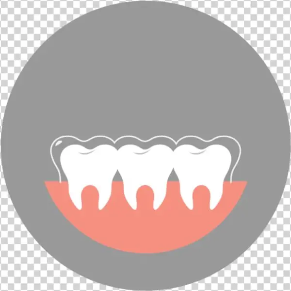Invisalign-art - Illustration