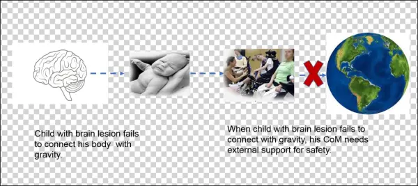 Child With Brain Lesion Can Not Connect To Gravity - Sphere