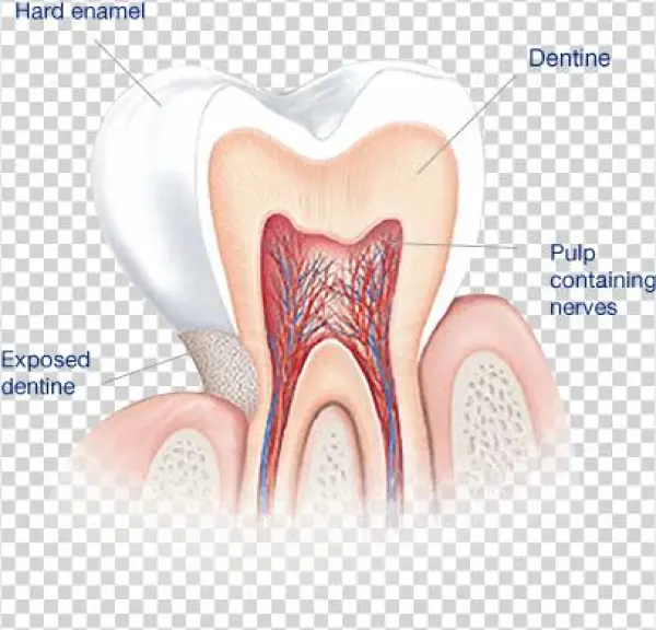 What Causes Sensitive Teeth - 牙 本质