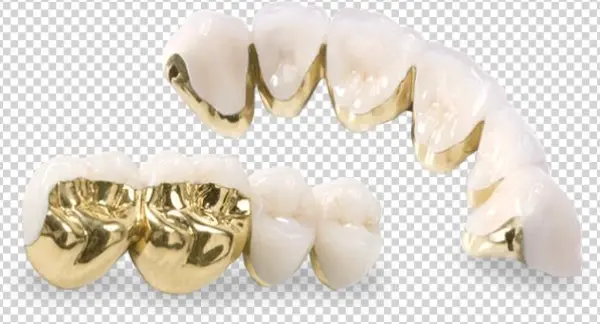 Estetska Stomatologija Zlato