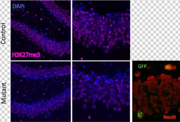 Methylation Status And Mecp2-gfp Reactivation Are Shown - Xist