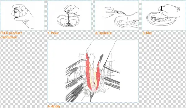 Prereration Of D-plex - Graphics