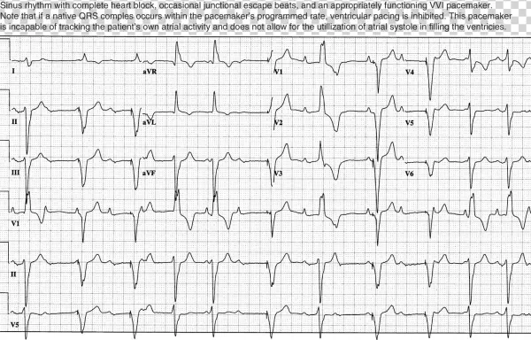 Image Not Available - Handwriting