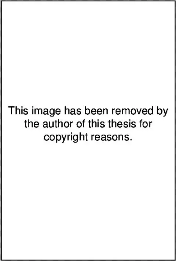 Metal Frame And Pelvic Restraint Device - Bitung