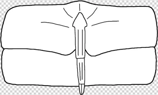 Nanahughmilleria Norvegica Genital Appendage - Illustration