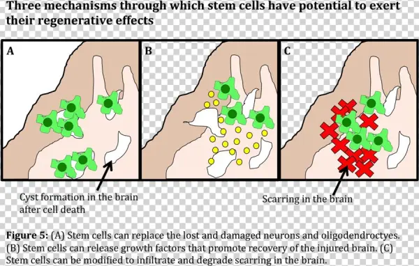 Subjective Essay Xex - Tree