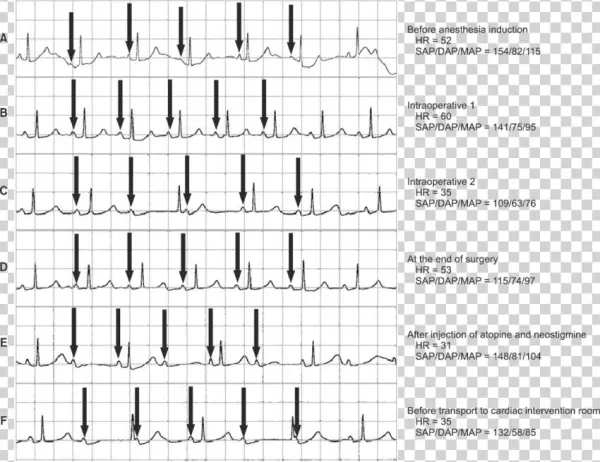 Electrocardiogram Waveforms And Vital Signs Were Retrieved