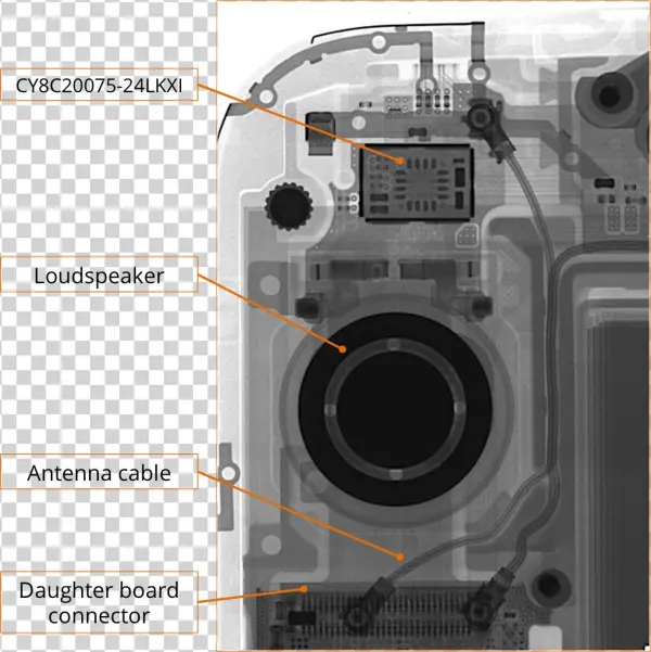 The Next Detail X Ray Image We Took Shows The Top Right