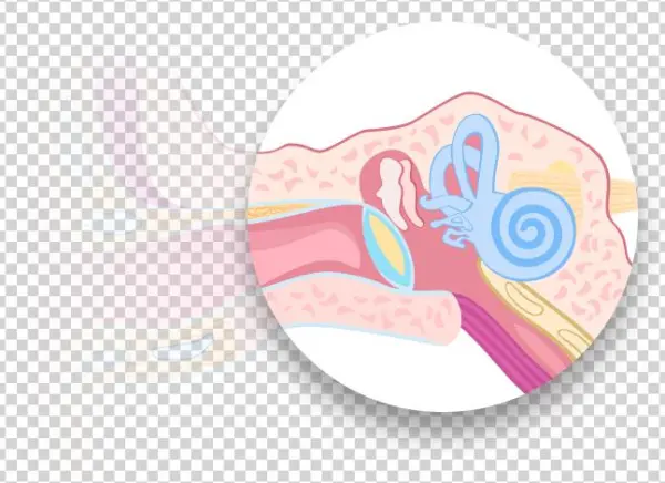 Conductive Hearing Loss - Text