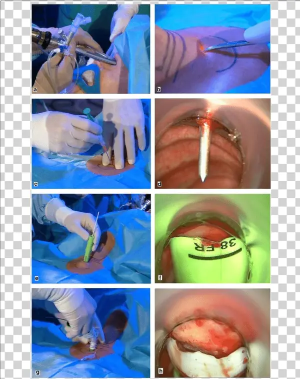 Handling The Ted - Collage