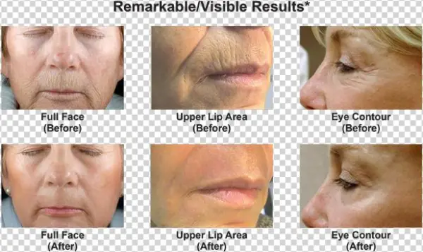 What Can Dot Co2 Therapy Do For Me - Collage