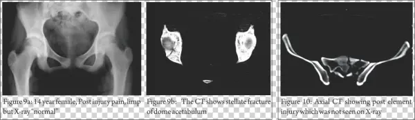 These Images Are Easy To Understand, Easy To Manipulate - Medical Imaging