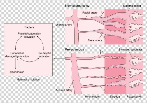 Schematic Representation Of Trophoblast Invasion Of - Trophoblast