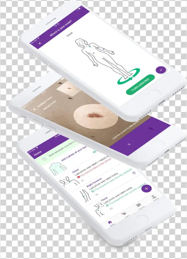 Track Skin Changes With Photos - Case