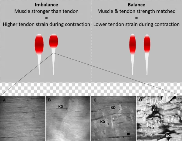 An Increase In The Stiffness Of The Tendon Results - Diagram