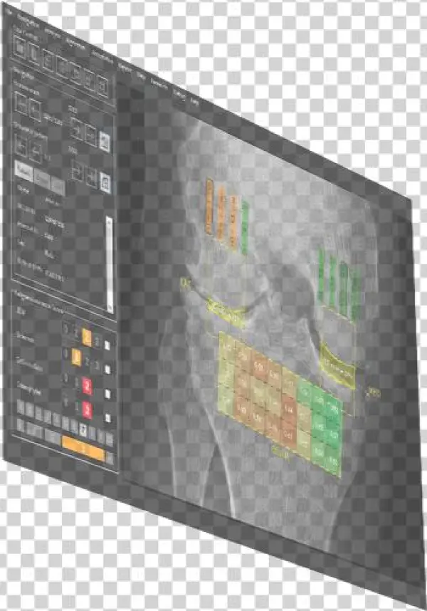 Image Biopsy Lab Software Laptop Image Biopsy Lab Software - Flat Panel Display